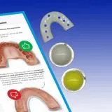 Mouthguard (ES)
